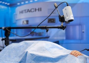 Chinese Doctor Used 5G To Perform World’s 1st Remote Brain Surgery On A Patient 3,000 Km Away
