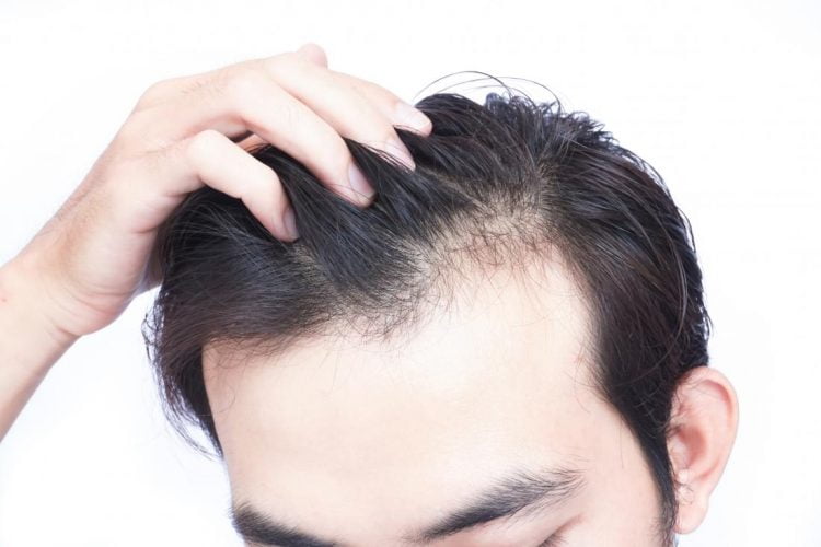 Top 5 Vitamins & Supplements for Faster Hair Growth