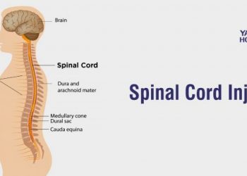 Spinal injury: The Importance Of getting First Aid Right