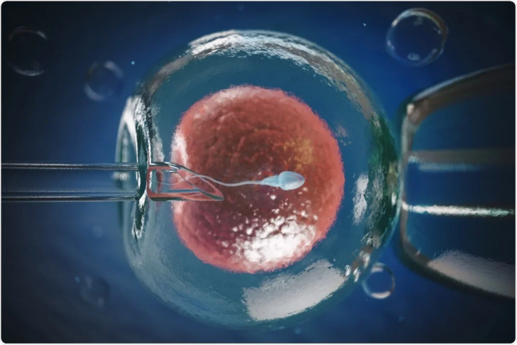 Low-Cost IVF Treatment in India