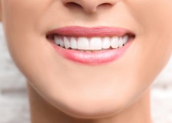 Few Tips for Choosing a Composite Bonding Service