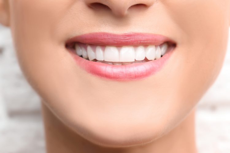 Few Tips for Choosing a Composite Bonding Service