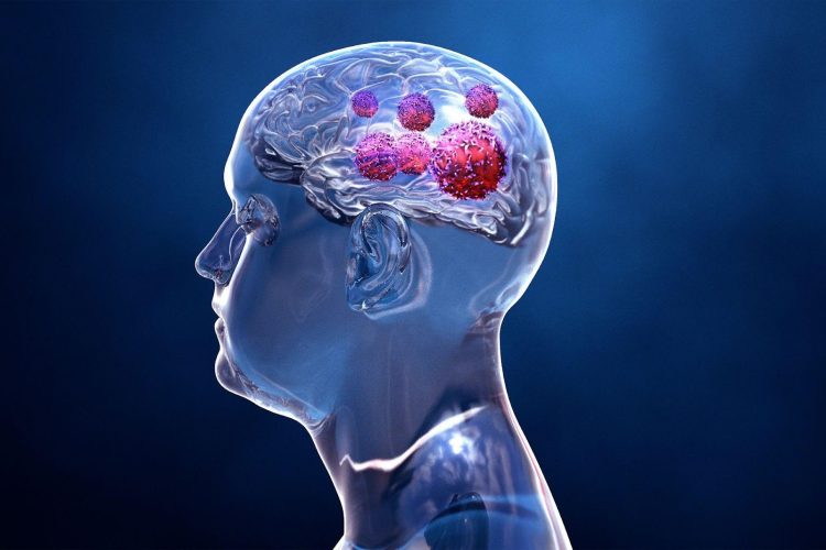 6 Overlooked Symptoms of Traumatic Brain Injury