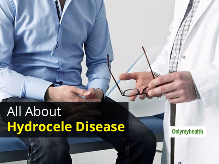 Diagnosis and Treatment of Hydrocele During 
